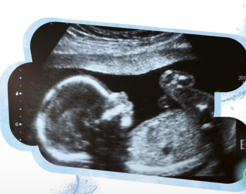 Düşük Riski Olan Gebeler Nelere Dikkat Etmeli?