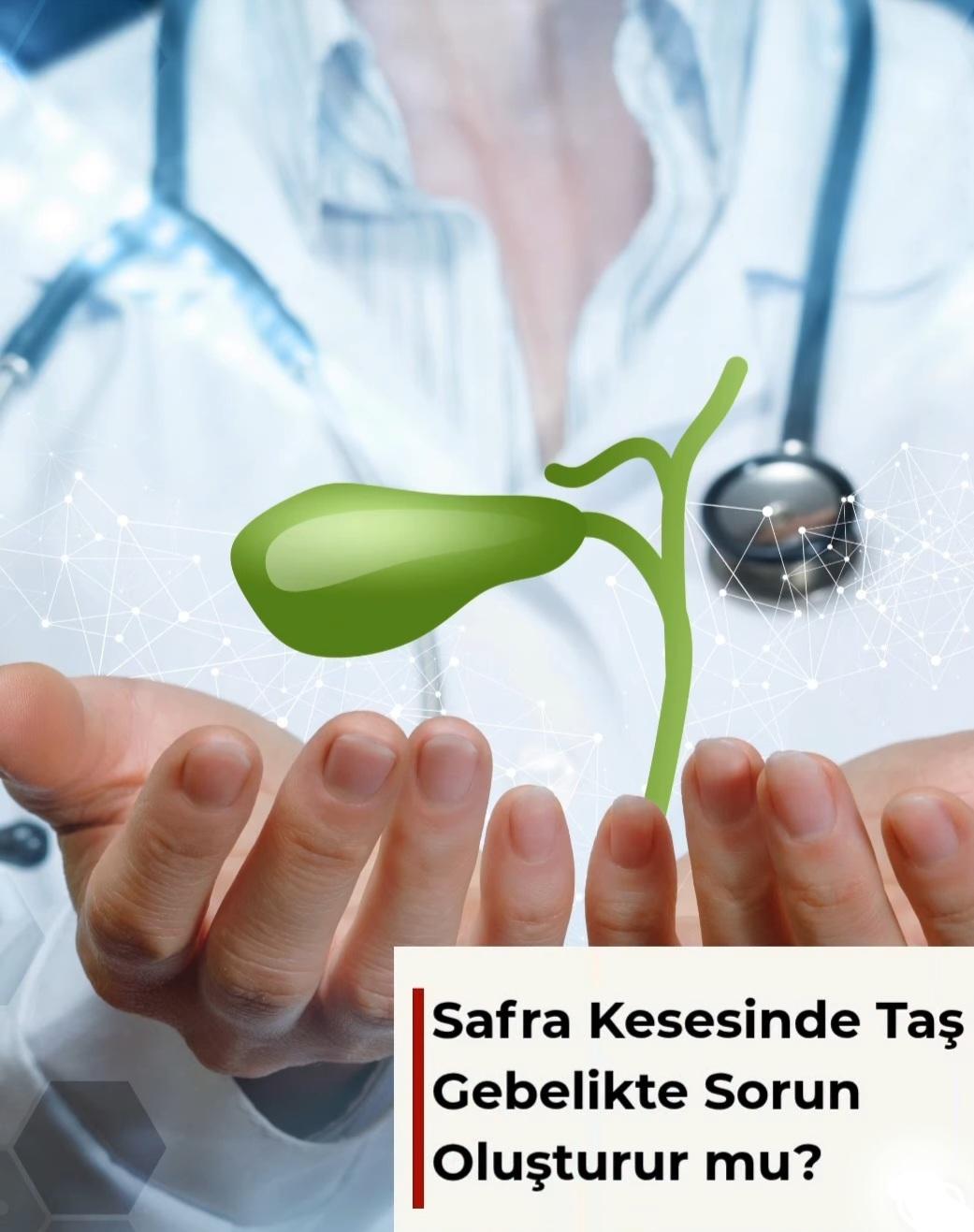 Safra Kesesinde Taş Gebelikte Sorun Oluşturur mu?